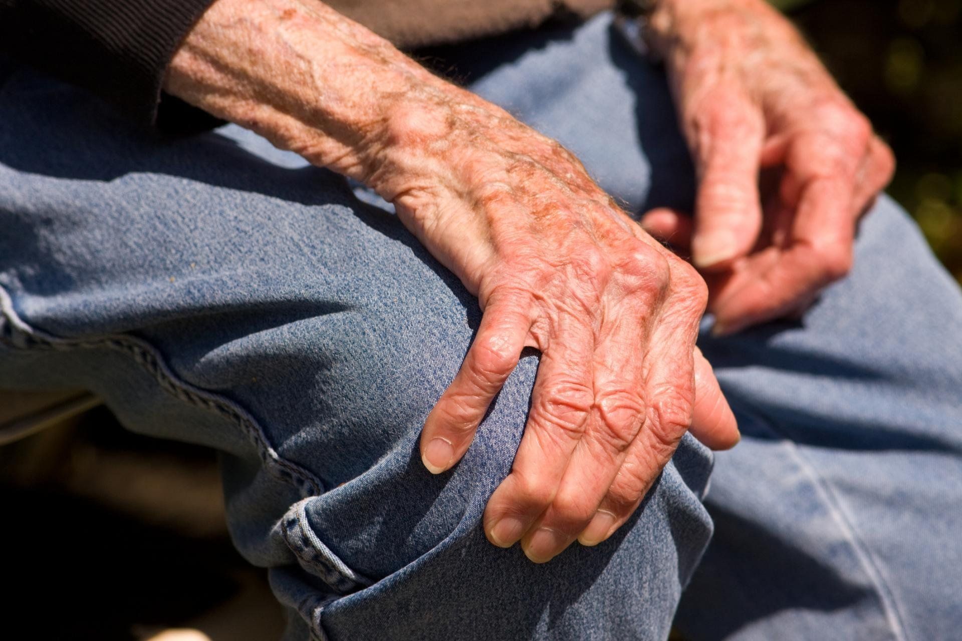 Симптомы и признаки болезни Паркинсона у пожилых людей